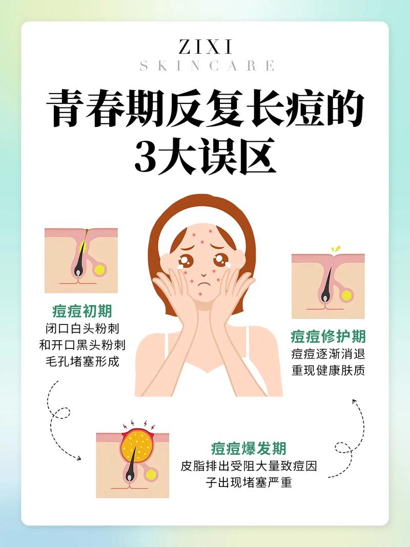 青春痘注意什么