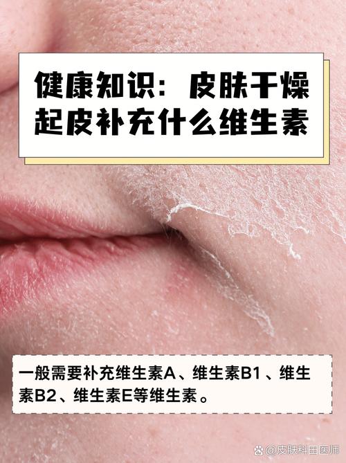 冬天皮肤干燥用什么