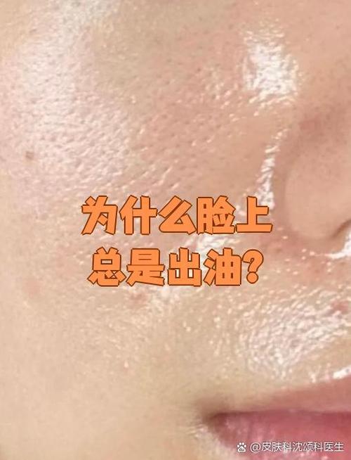 皮肤为什么会出油