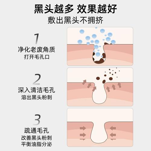 什么护肤品可以去黑头