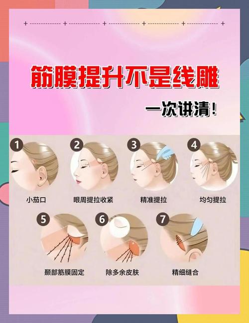 线雕原理是什么