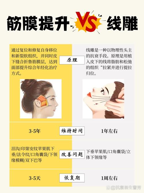 线雕原理是什么