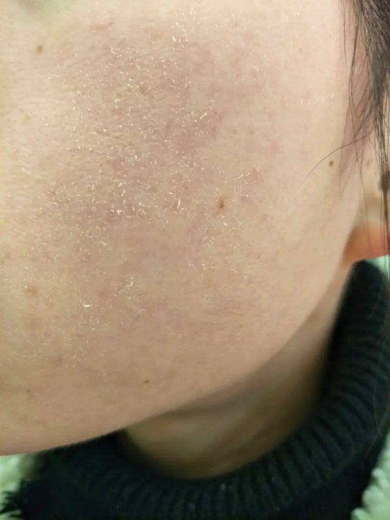 用完洗面奶后脸上很干