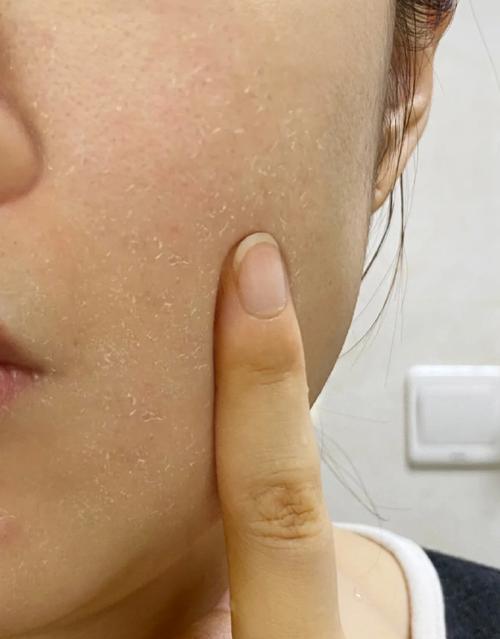 用完洗面奶后脸上很干