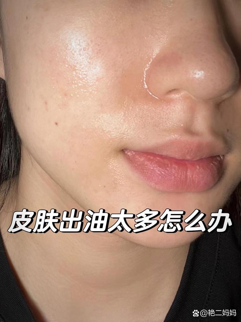 用了保湿护肤品脸上油