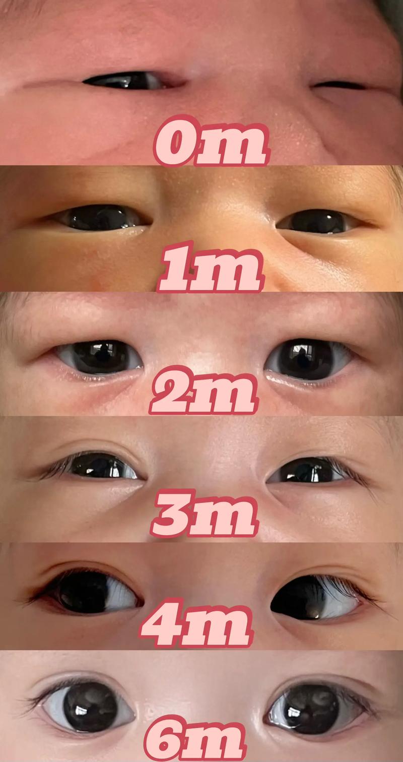 眼睛为什么一大一小