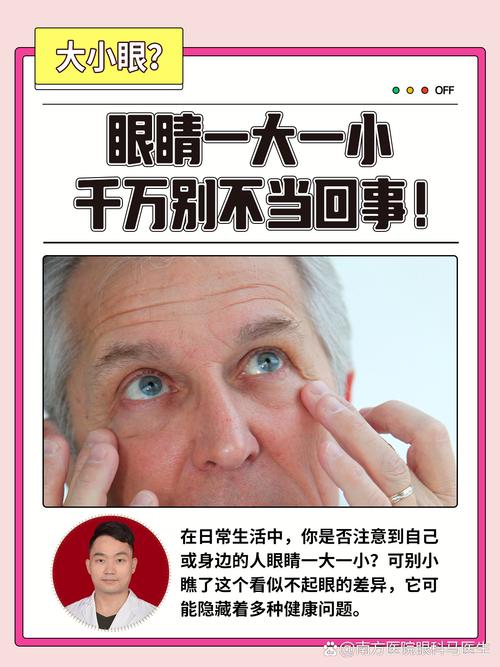 眼睛为什么一大一小