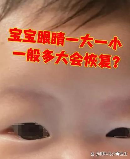 眼睛为什么一大一小