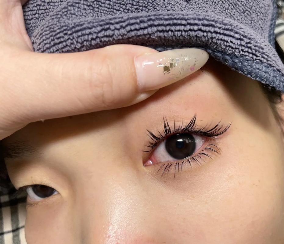 单眼皮是什么样的