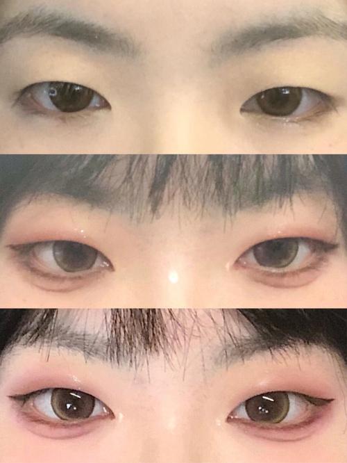 单眼皮是什么样的