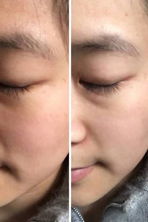 酵素粉前后要用洗面奶