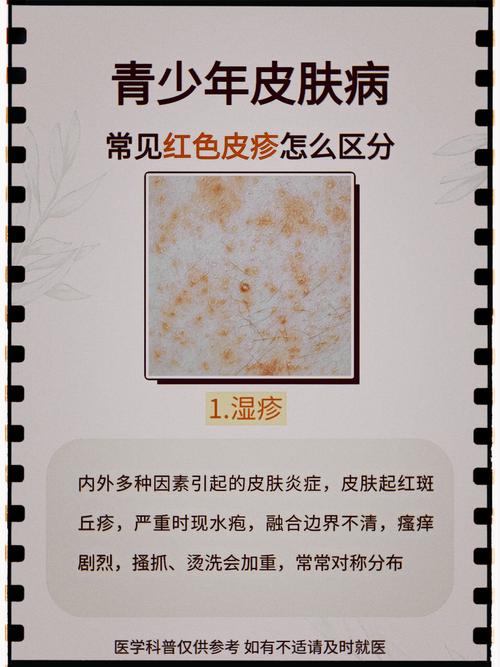 皮肤病看什么科