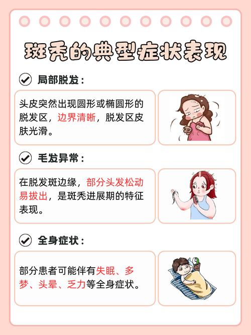 治疗脱发用什么药