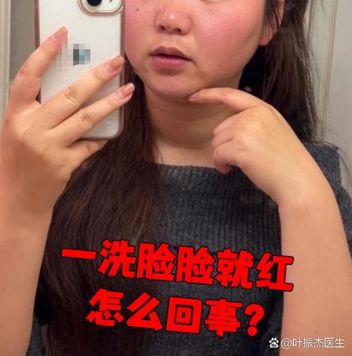 洗面奶洗脸后脸部刺痛