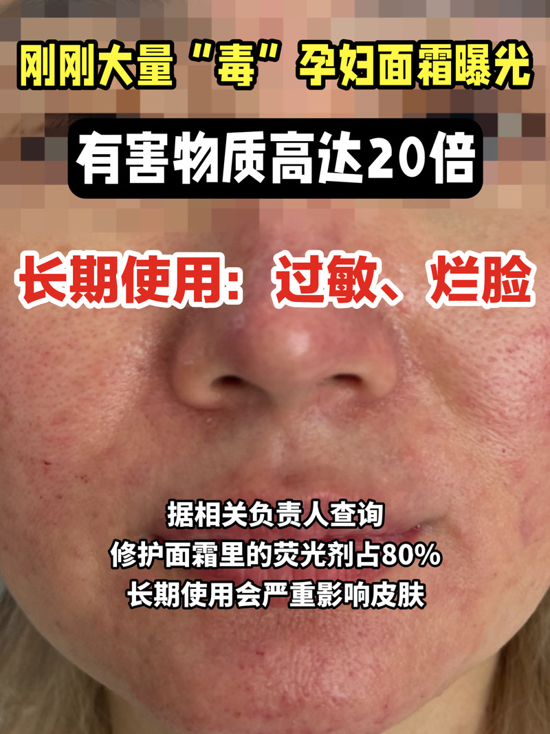 怀孕后用护肤品的危害