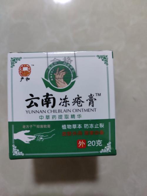 什么可以治冻疮