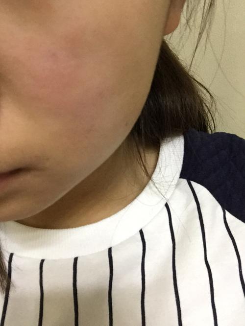 最近皮肤用护肤品刺痛