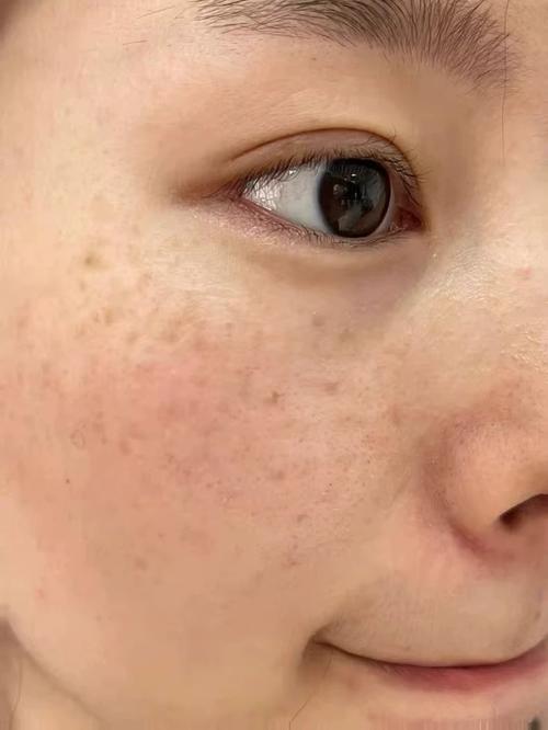 擦了护肤品 脸色暗沉