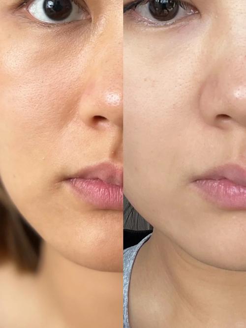 擦了护肤品 脸色暗沉