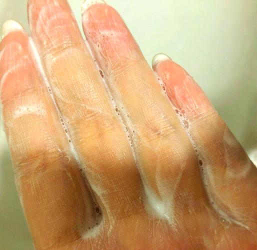 用cpb洗面奶老长痘