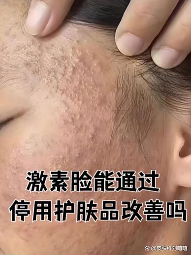 护肤品擦脸上多久吸收