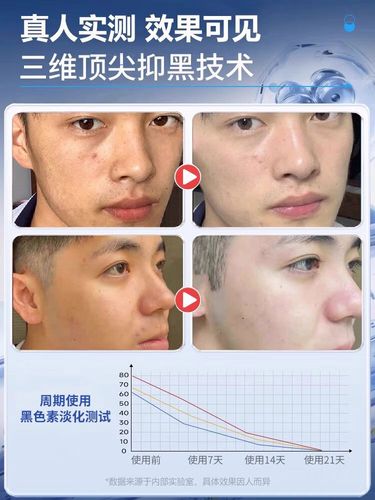 男生晒黑变白的护肤品