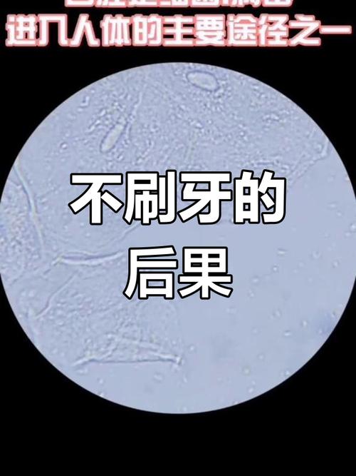 口腔有什么细菌