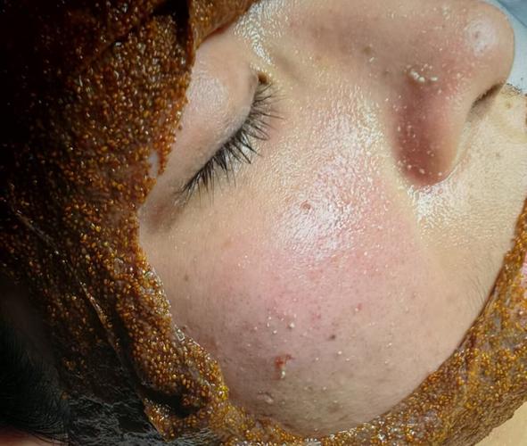 用洗面奶洗脸毛孔粗大