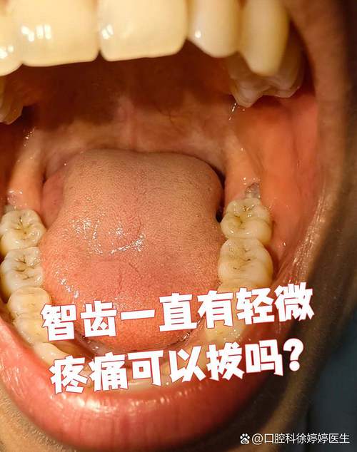 为什么长智齿会疼