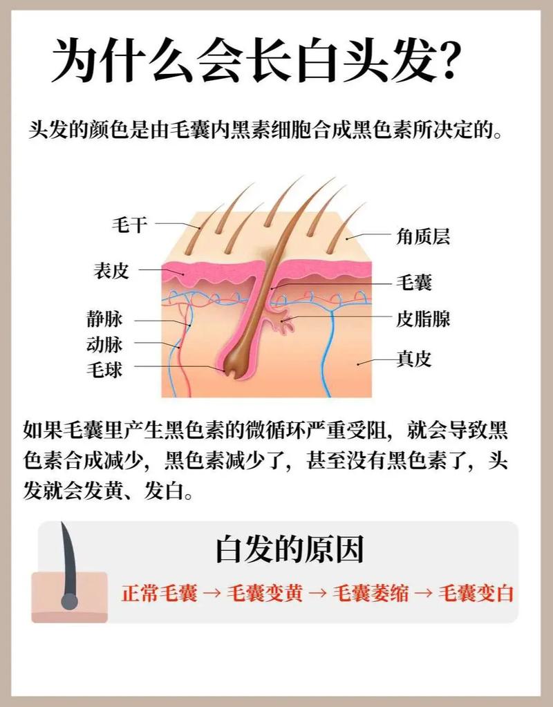 少白头什么原因