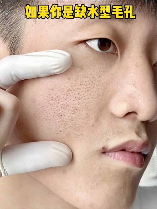 洗面奶会使毛孔变大吗