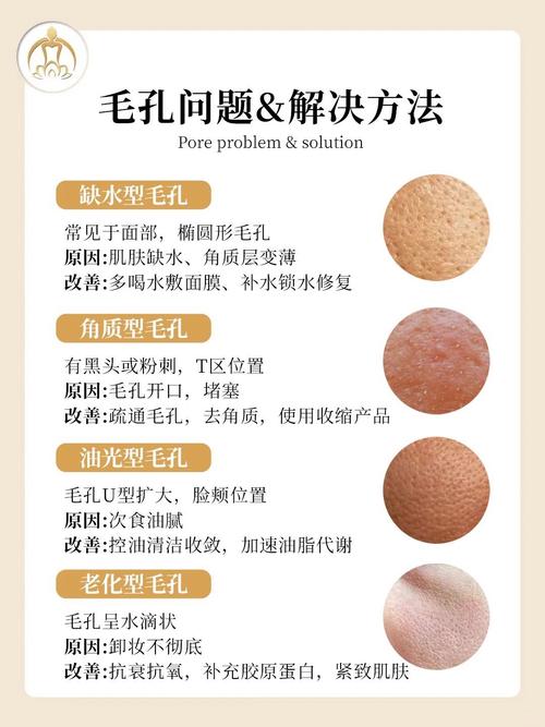 洗面奶会使毛孔变大吗