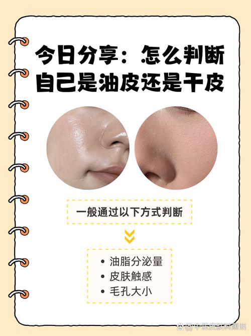 怎么判断护肤品有激素