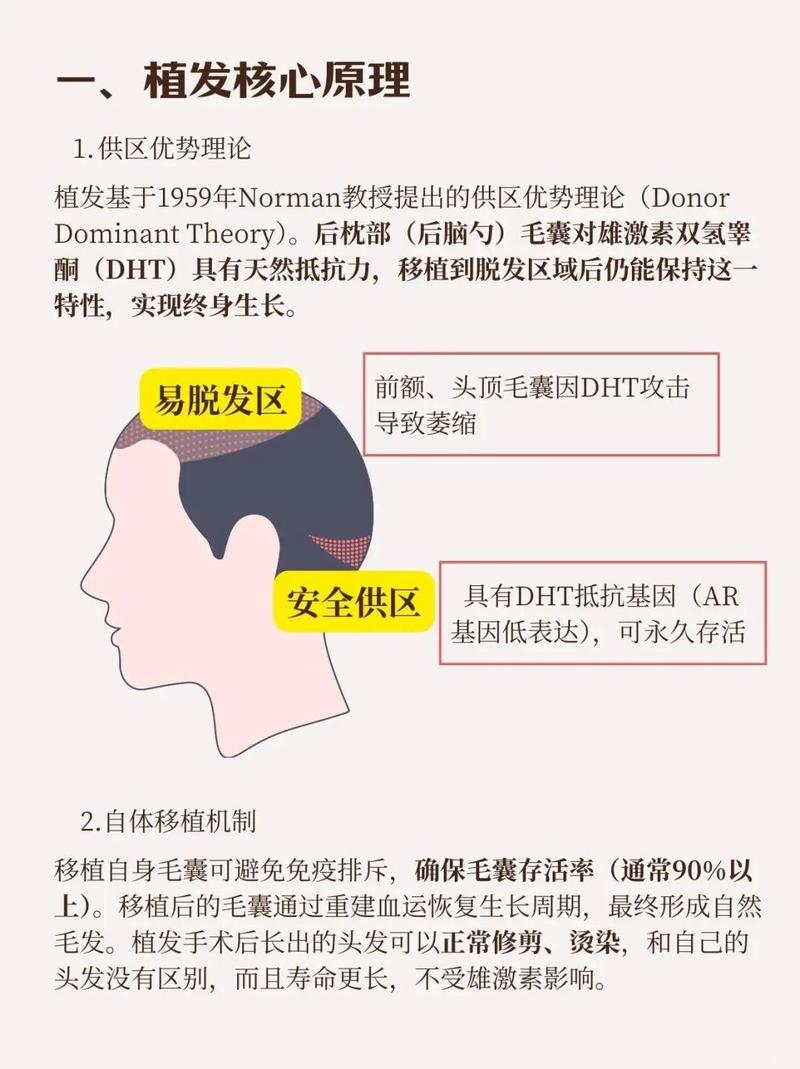 植发是什么原理