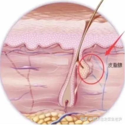 植发是什么原理