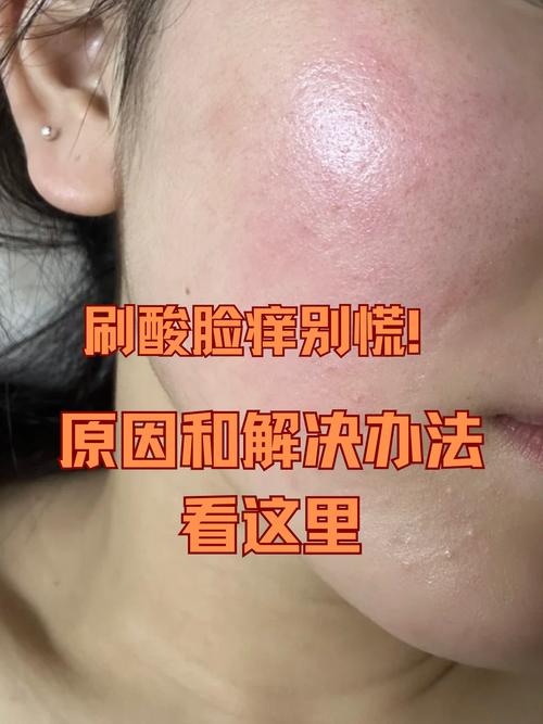 洗面奶过敏多久有反应