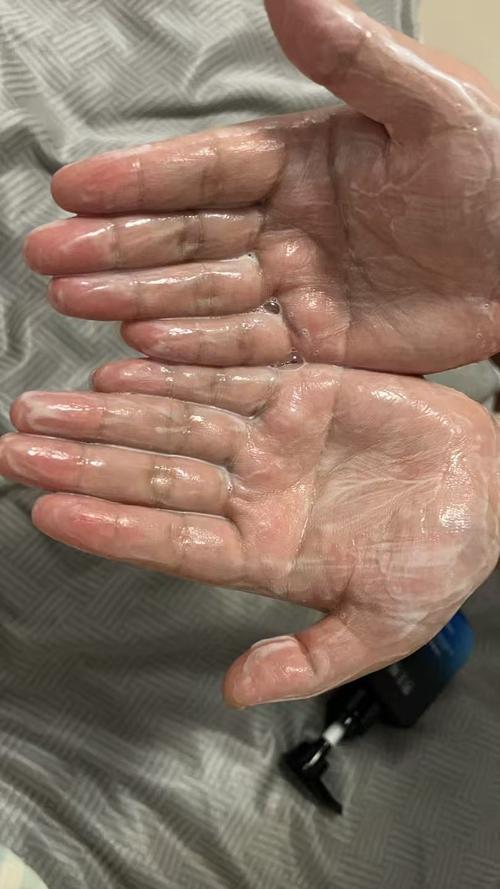 那种洗面奶收缩毛孔好