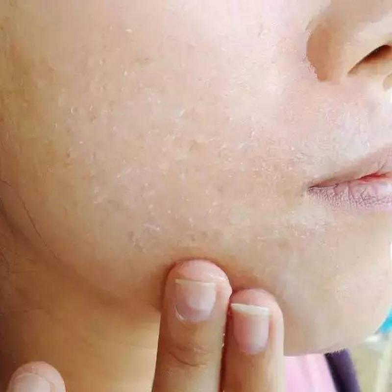 用完护肤品皮肤黏黏的