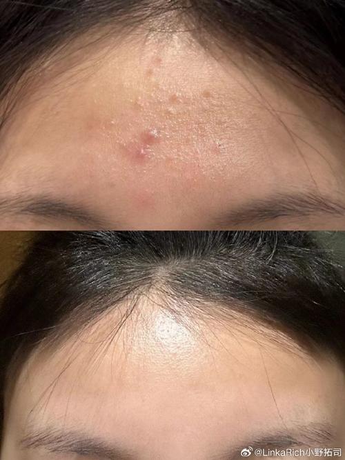 用完护肤品皮肤黏黏的