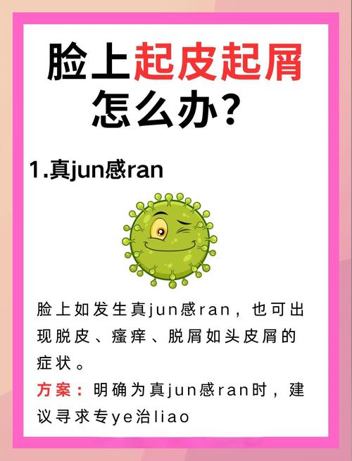 为什么脸会掉皮