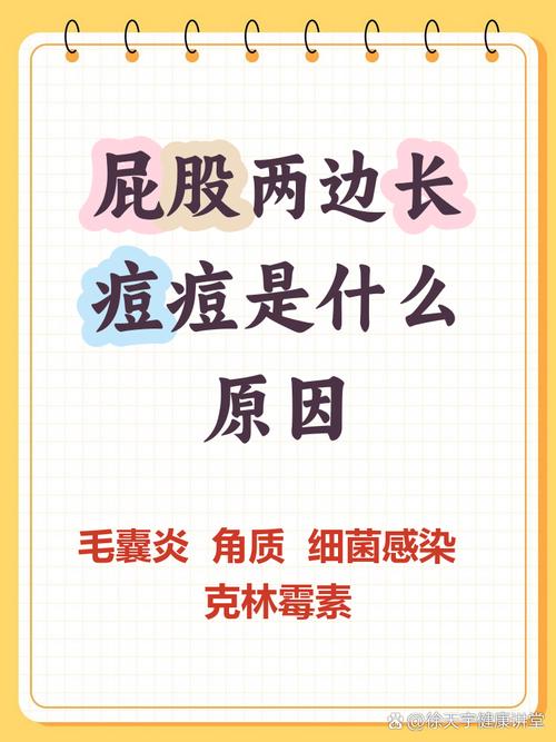 为什么屁股长痘