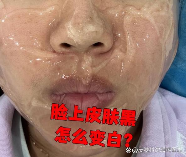 用补水护肤品皮肤变黑