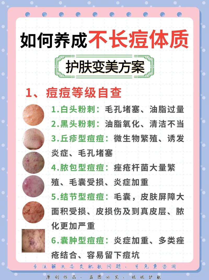 用护肤品爆痘是排毒吗