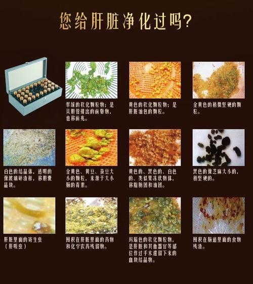 什么东西可以排毒