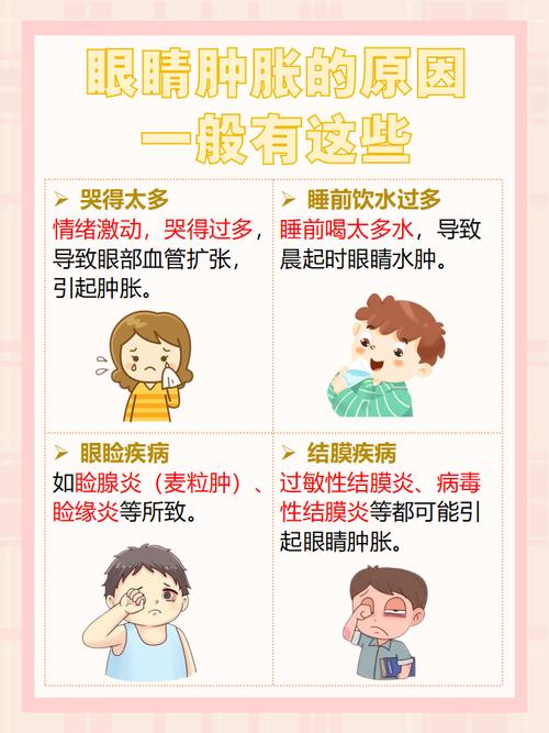 为什么眼睛总是肿