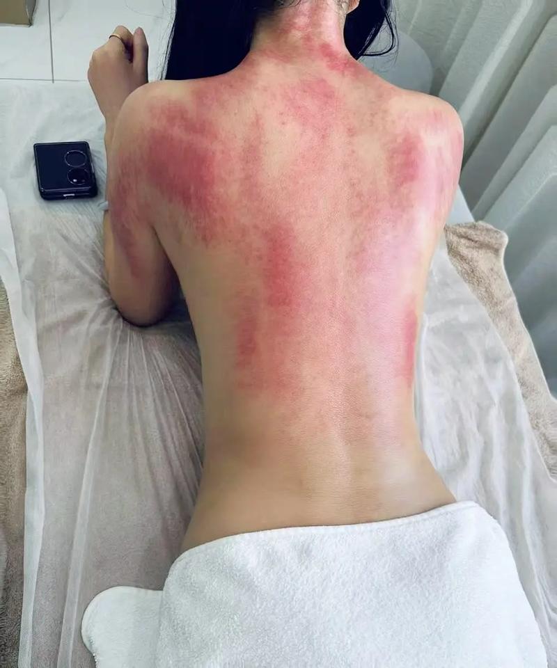 精油开背是什么