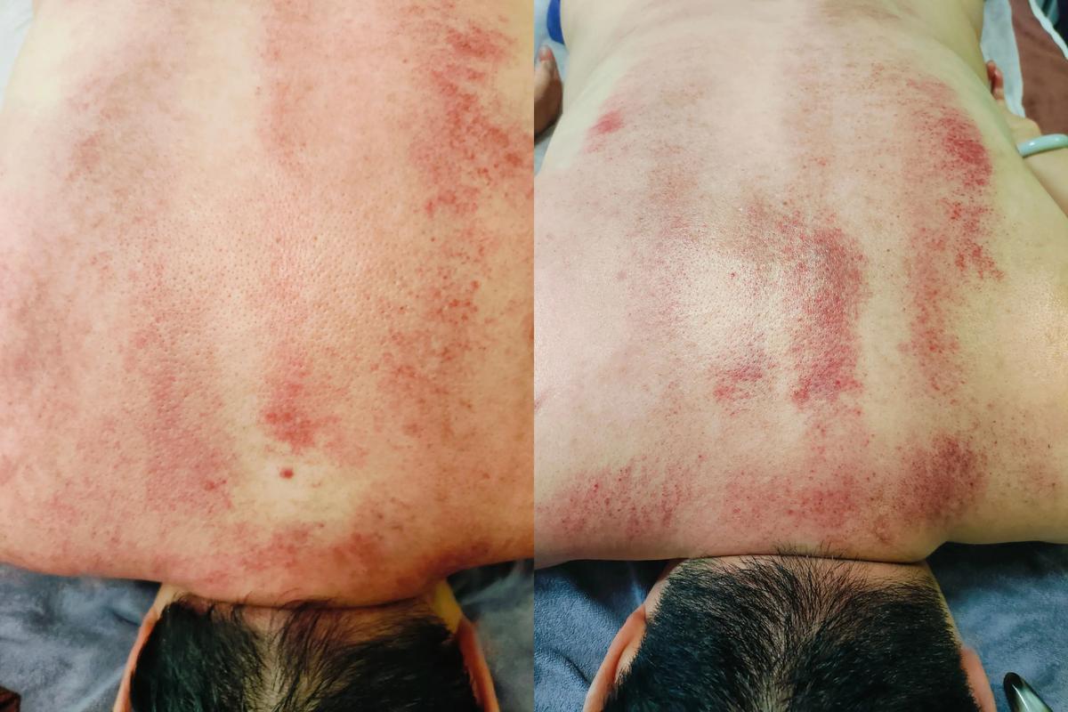 精油开背是什么