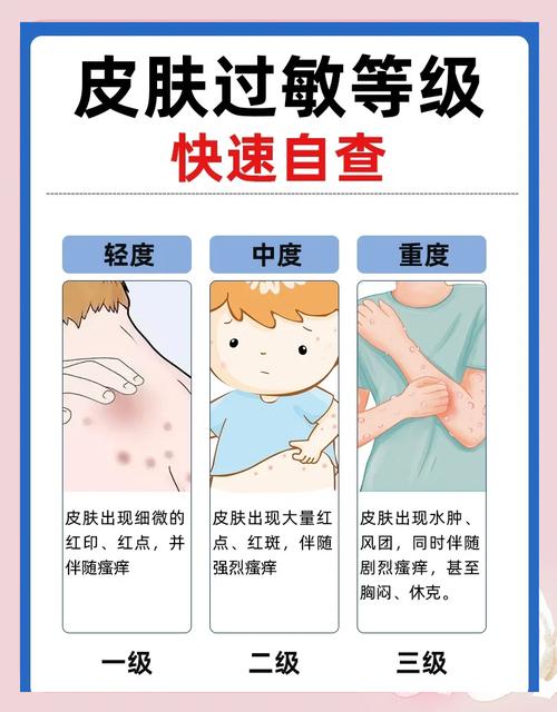 一般护肤品用多久过敏