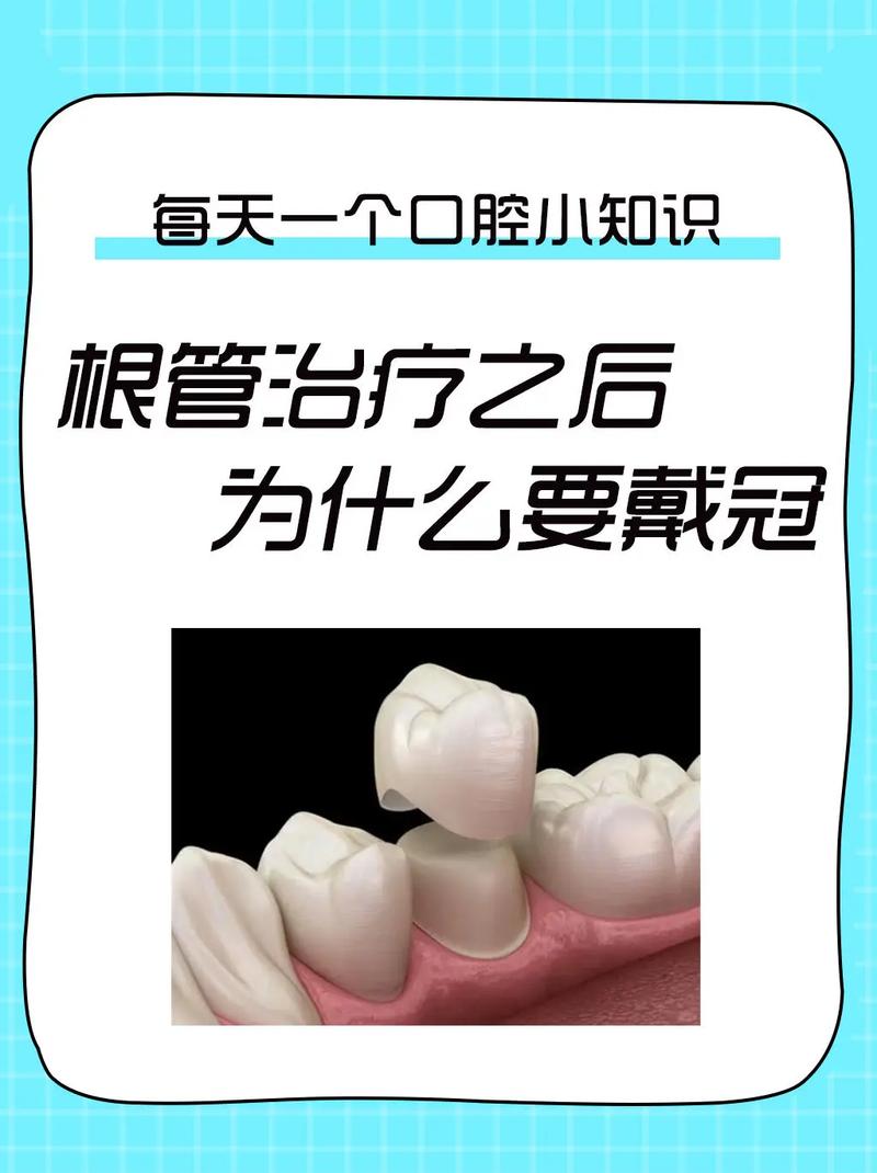 为什么要做牙套