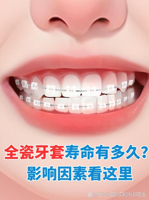 为什么要做牙套